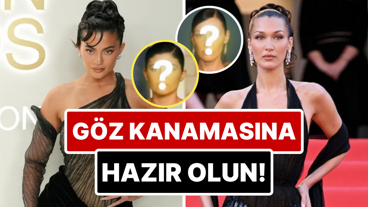 Göz Kanamasına Hazır Olun: Kylie Jenner'dan Hailey Bieber'a Hollywood Ünlüleri Estetiksiz Nasıl Gözükürdü?