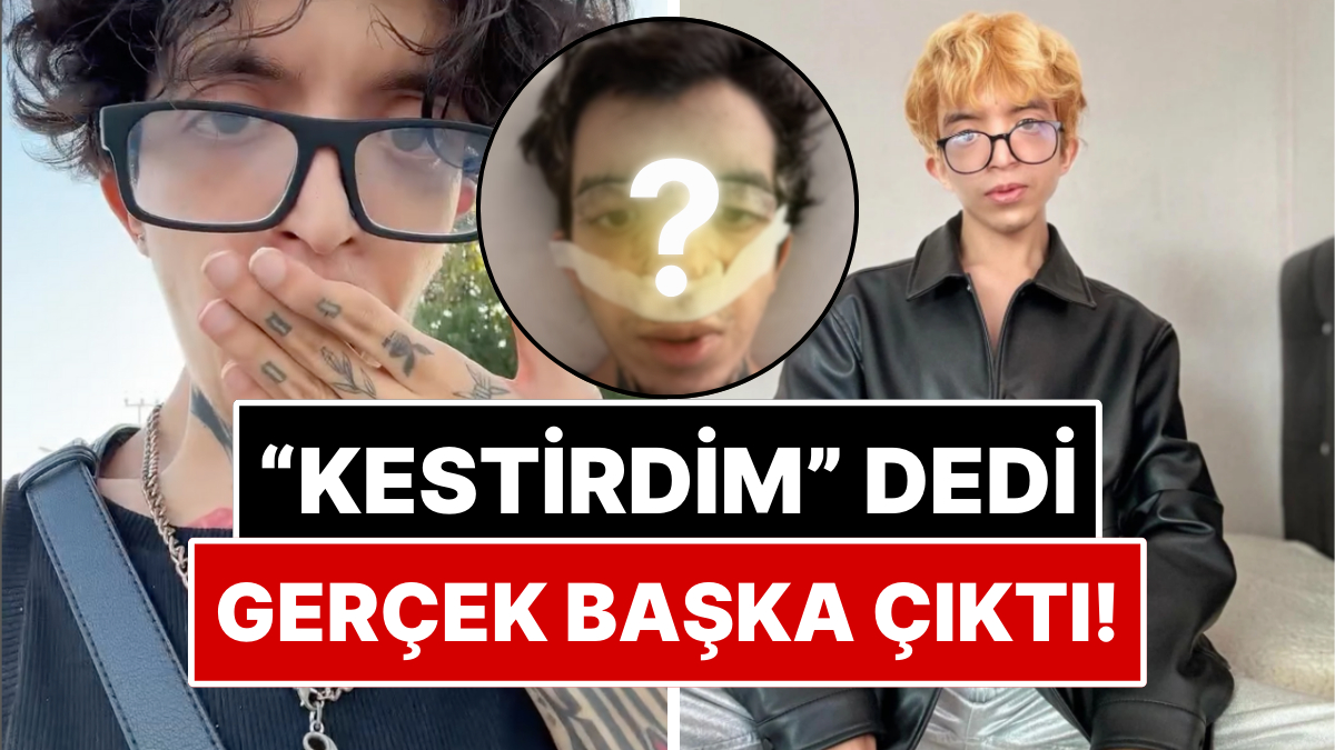 "Kestirdim" Deyip Cinsiyet Geçiş Ameliyatı Olduğuna İnandıran 'Tablet Reis' Yaptırdığı İşlemi Açıkladı
