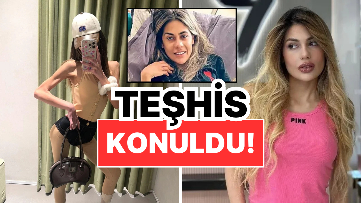 37 Kiloya Kadar Düşen Nihal Candan’ın Sağlık Durumu Kötüye Gidiyor: Organ Yetmezliği Teşhisi!