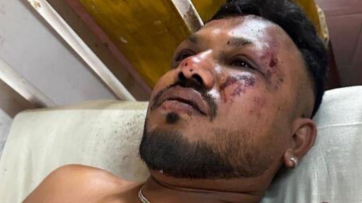 Hindistan’da uçak kazasından sağ kurtulan yolcu o anları anlattı