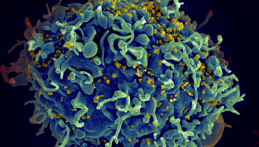 HIV tedavisinde çığır açacak adım: mRNA temelli yöntem umut verdi