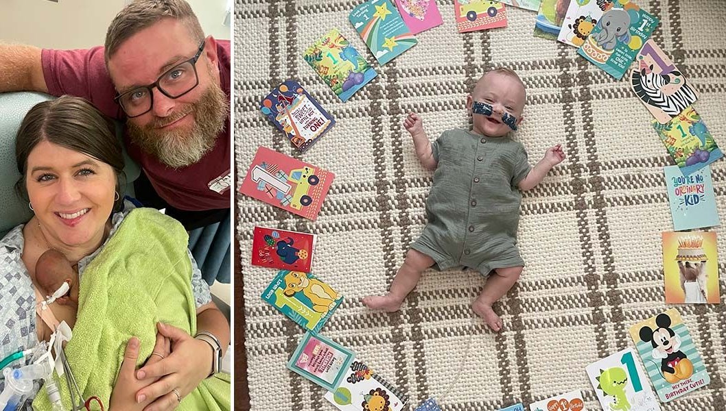 Dünyanın en prematüre bebeği: 280 gram doğdu, doktorlar yaşamaz dedi