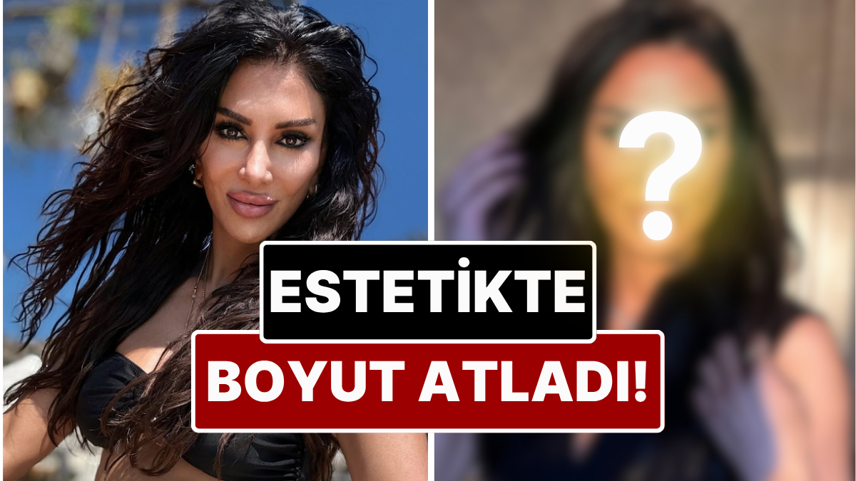 Yok Böyle Estetik: Güzellik Merkezleri Sahibi Emsal Doğan Geçirdiği Operasyonla Gözlerinin Rengini Değiştirdi!