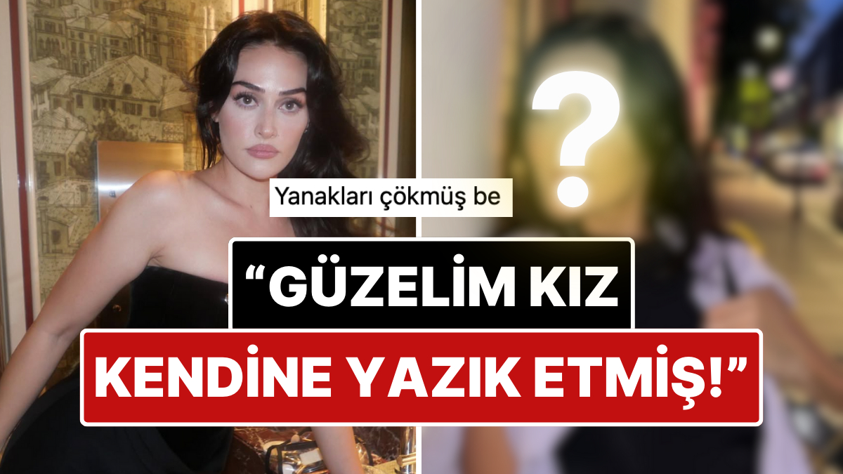 Estetik Kervanına Katıldı: Güzelliğiyle Büyüleyen Esra Bilgiç’in Estetikli Yüzü Doğal Haliyle Karşılaştırıldı!
