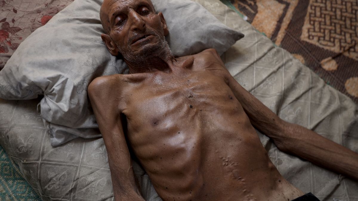 Gazze’de soykırım: 75 yaşındaki adam 40 kiloya düştü