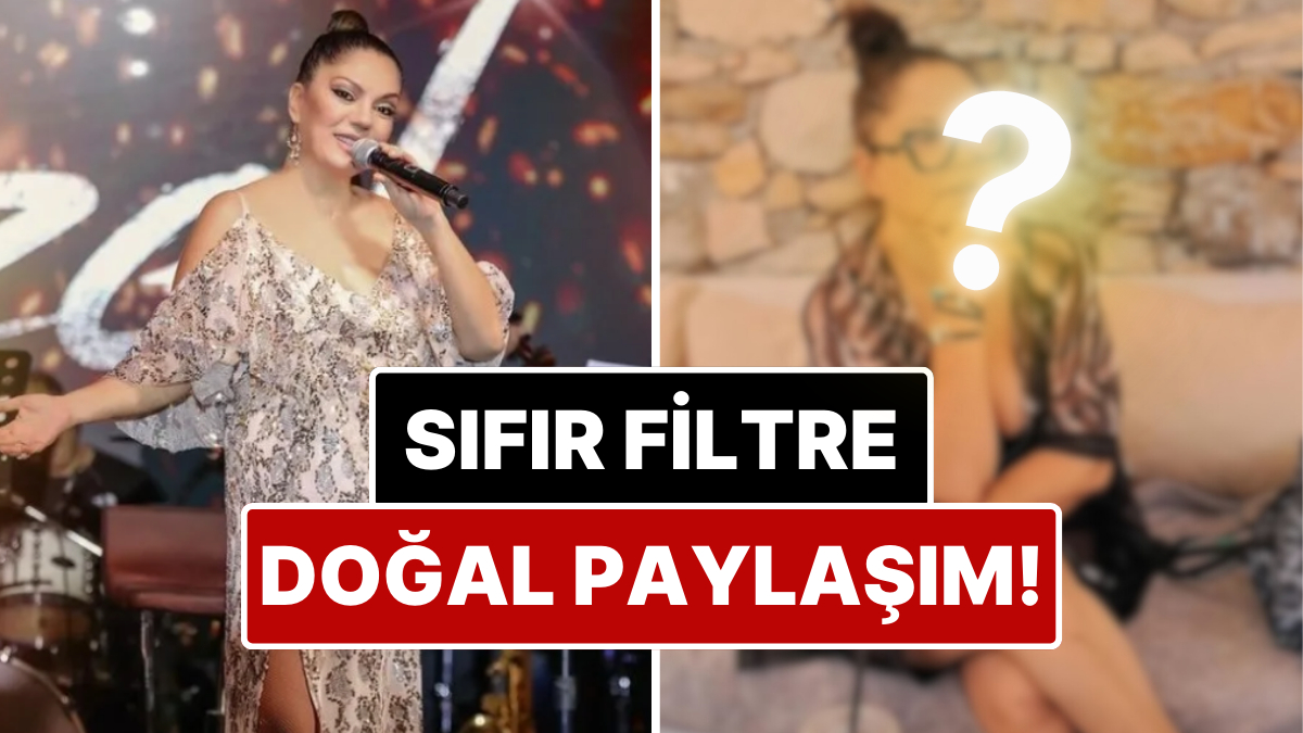 Güzellik Kalpılarına Rest Çekti: Bir Dönem Yüzündeki İzlerle Çok Konuşulan İzel'den Filtresiz Paylaşım!