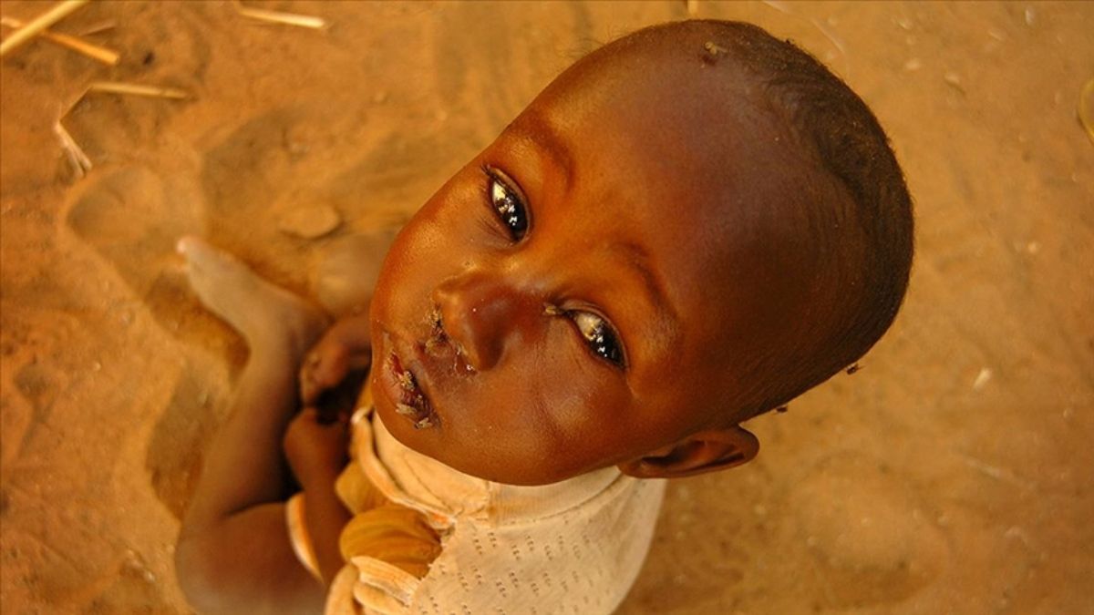UNICEF’ten Sudan uyarısı: 5 yaş altı 640 bini aşkın çocuk, açlık ve hastalık yüzünden risk altında