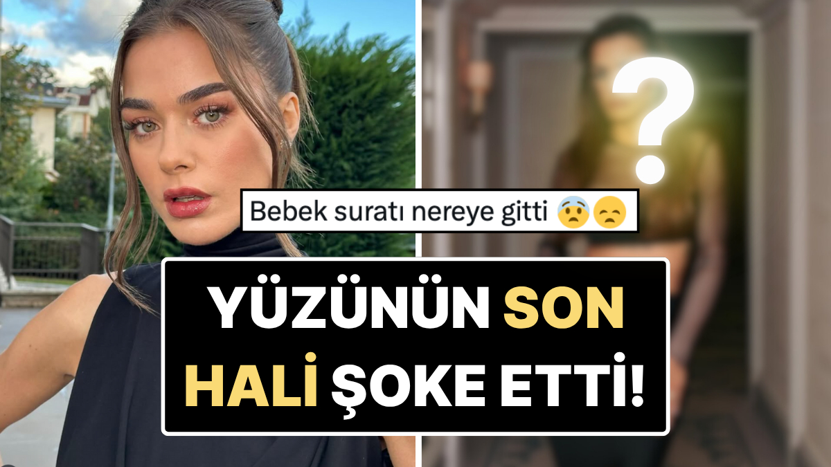 "Eski Doğallığı Nereye Gitti?" Paris Moda Haftası'na Katılan Bensu Soral'ın Yüzünün Son Hali Dikkat Çekti