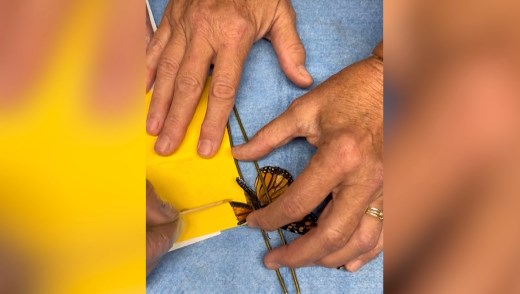 Kelebeğe ikinci şans… Kanat nakliyle yeniden uçtu