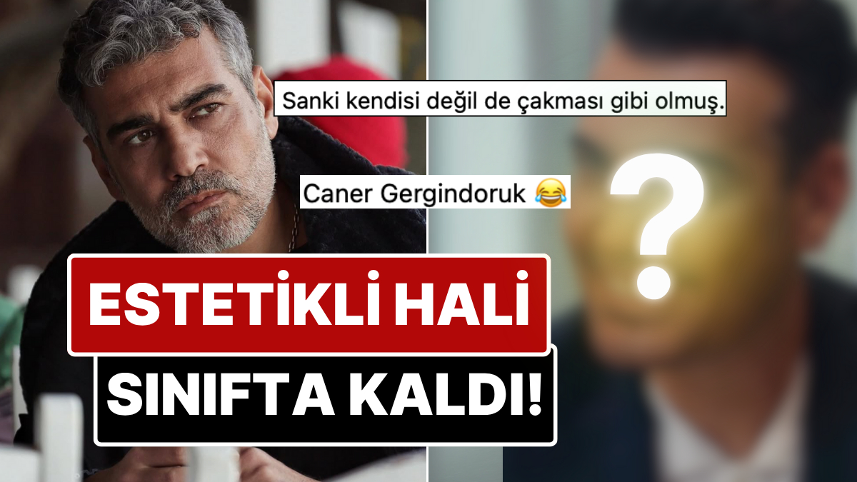 Saçlarını Boyatıp Dişlerini Yaptıran Caner Cindoruk'un Estetikli Son Halini Görenler Tanımakta Zorlandı!