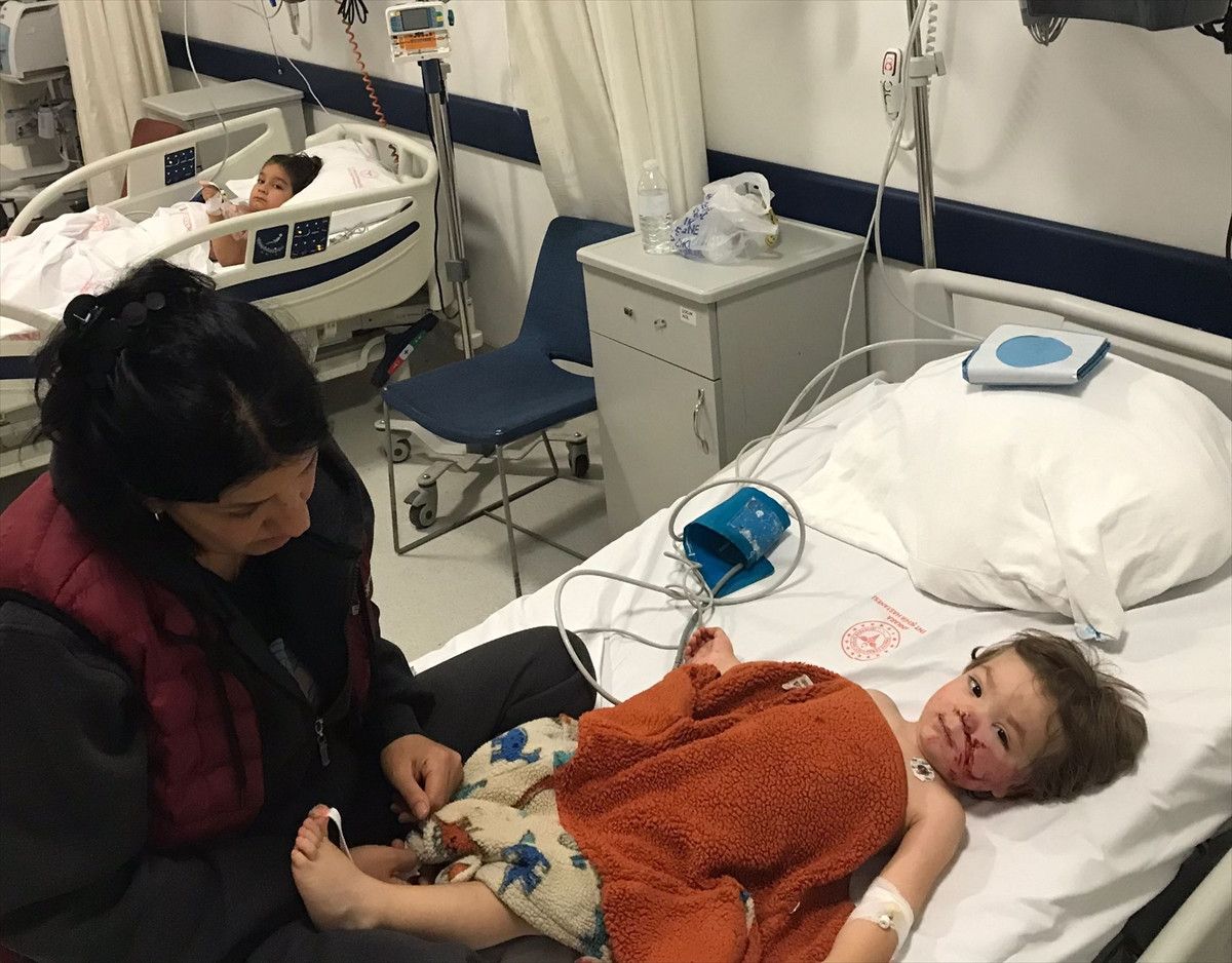 Ankara’da pitbull cinsi köpeğin saldırısına uğrayan çocuğun yüzü paramparça oldu